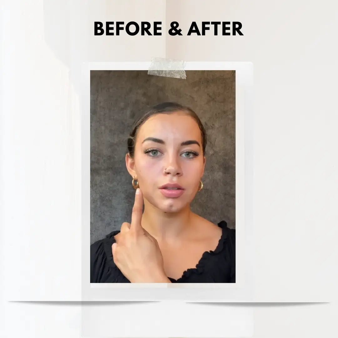 Facial Lifting Beauty Device - ThriveAuraOutlet