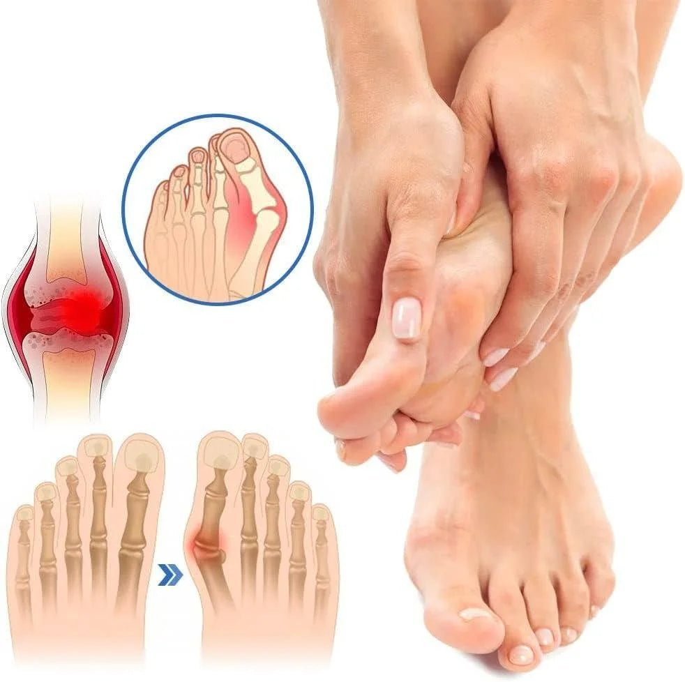 Anti - Bunion & Vein Health Socks for Women & Men - ThriveAuraOutlet