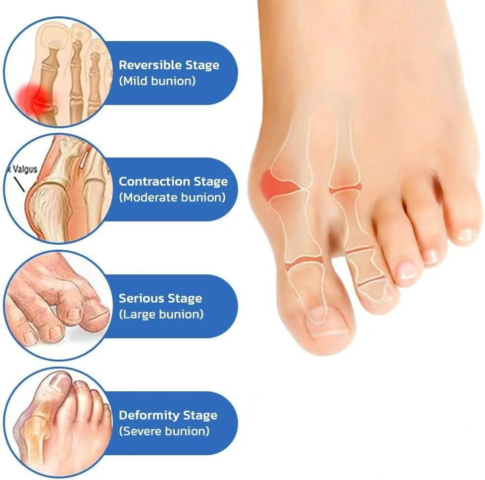 Anti - Bunion & Vein Health Socks for Women & Men - ThriveAuraOutlet