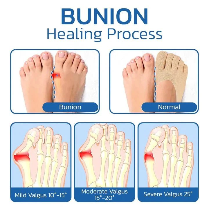Anti Bunions Health Sock - ThriveAuraOutlet