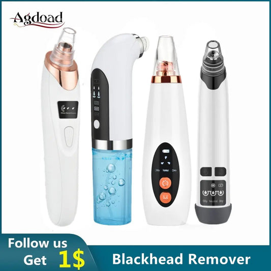 Beauty Electric Blackhead Remover - ThriveAuraOutlet