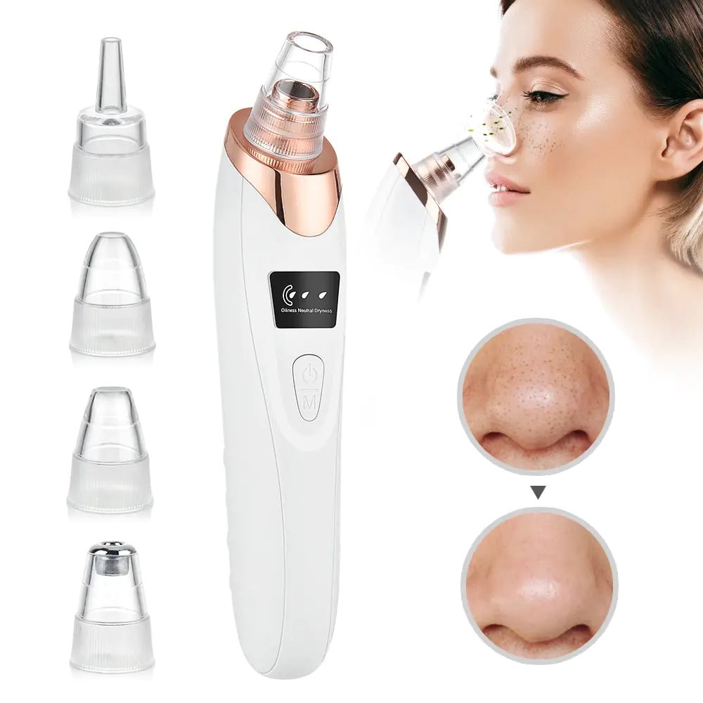 Beauty Electric Blackhead Remover - ThriveAuraOutlet
