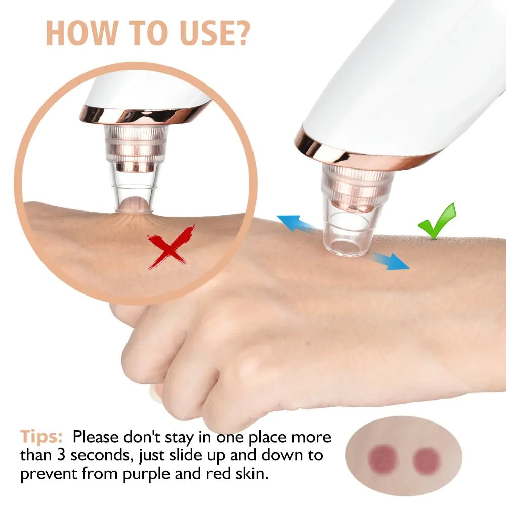 Beauty Electric Blackhead Remover - ThriveAuraOutlet