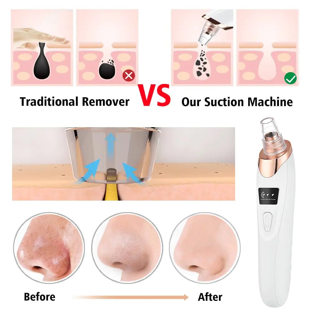 Beauty Electric Blackhead Remover - ThriveAuraOutlet