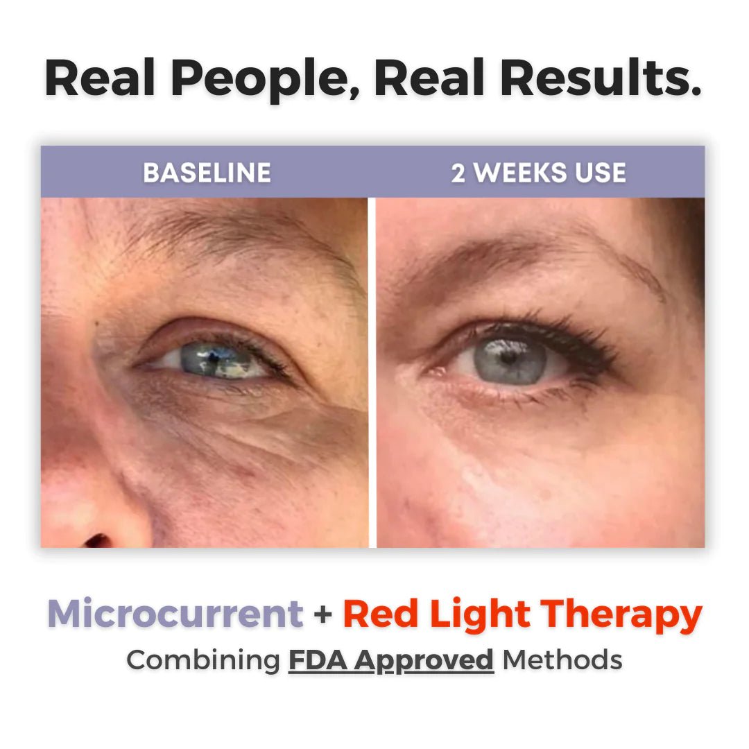 Eye Beauty Pro - ThriveAuraOutlet