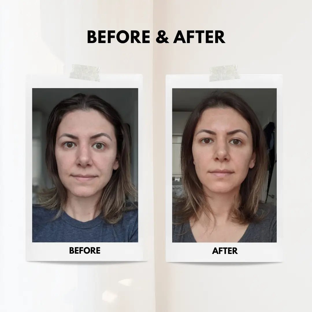 Facial Lifting Beauty Device - ThriveAuraOutlet