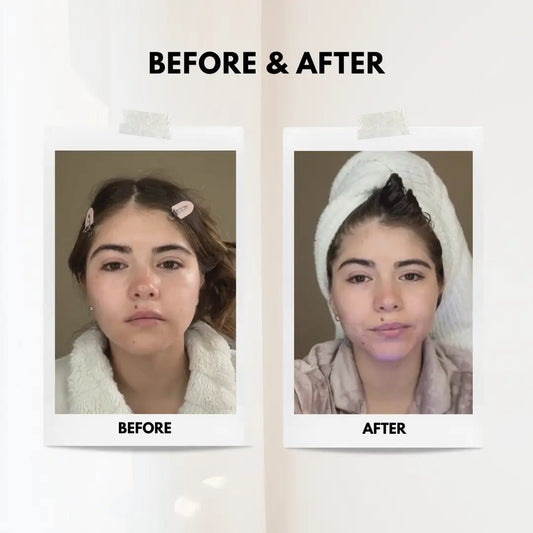 Facial Lifting Beauty Device - ThriveAuraOutlet